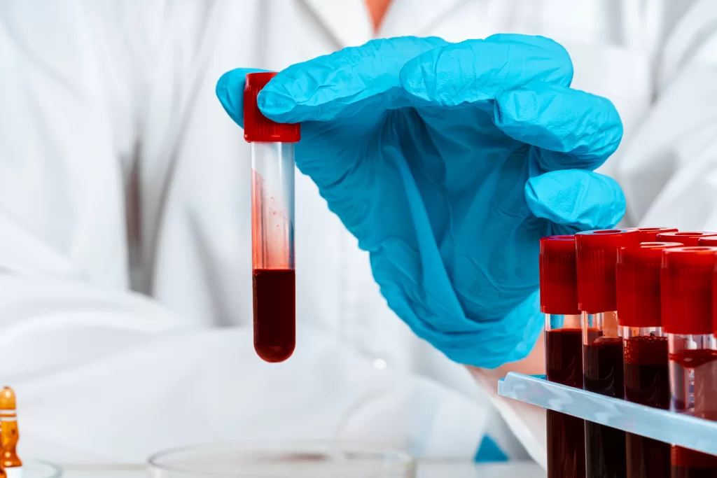 Auxiliar en Hemoterapia